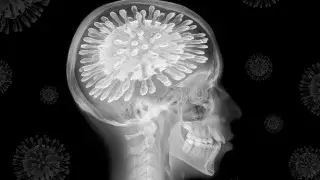 Ученые описали повреждения мозга при коронавирусе