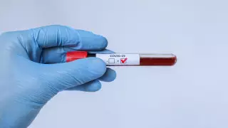 Рекордный суточный прирост заболевших COVID-19 зарегистрирован в США