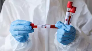 Более 100 футболистов итальянской серии А заразились коронавирусом - СМИ