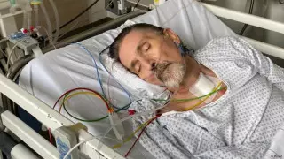 "Пролежал в коме 2 месяца": шокирующий рассказ немца с коронавирусом