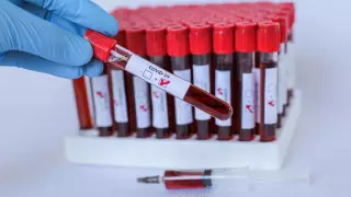 Житель Индии потребовал 677 тысяч долларов после испытания вакцины от коронавируса