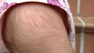 Дети массово заболели "синдромом оборотня" в Испании