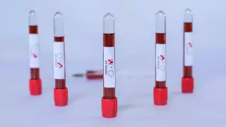 10 казахстанцев умерли от коронавируса и пневмонии