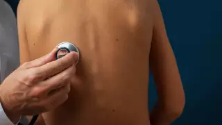 Неожиданный симптом рака легких назвали медики