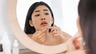 "Треугольник смерти". Какие прыщи на лице опасно выдавливать