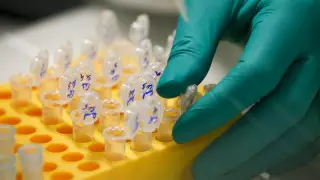 Израильские ученые нашли ахиллесову пяту раковых клеток