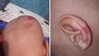 "Подхватили синегнойную палочку" - карагандинка пожаловалась на медиков