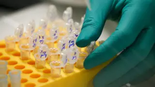 Названы пять часто игнорируемых симптомов рака