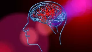 Названы 5 способов снизить риск инсульта