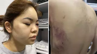 "Я думала, этот кошмар никогда не закончится": бывший муж избил 23-летнюю астанчанку