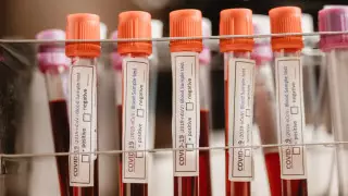 Два повторных случая коронавируса зарегистрировано в Казахстане - Минздрав