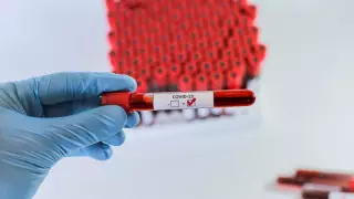 2142 человека заразились коронавирусом в Казахстане за сутки