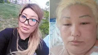 Жительница Уральска попала в реанимацию после посещения салона красоты