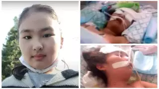 "Слишком много наркоза". Девочка впала в кому после операции в Шымкенте