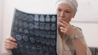 Перечислены ранние признаки одного из самых распространенных видов рака