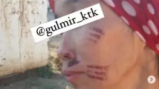 "Бетін қызған шанышқымен күйдірген". Түркістан облысындағы сұмдық жайтқа полиция пікір білдірді