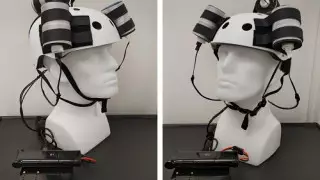 Опухоль мозга впервые уменьшили с помощью магнитного шлема