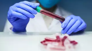 Испытания революционного теста на рак начались в Великобритании