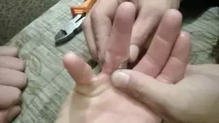 Застряло кольцо на пальце: костанайским спасателям пришлось выезжать на необычную спецоперацию