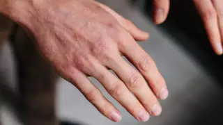 Врачи описали новый симптом коронавируса