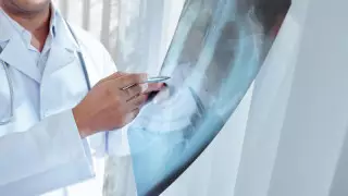 Сколько казахстанцев умерли от коронавируса и пневмонии за сутки