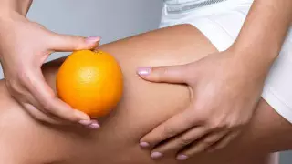 Диетолог назвала способы избавиться от "апельсиновой корки"