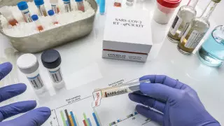 "Омикрона" в ЗКО нет - санврачи