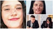 Девушка вышла замуж за парня, облившего ее серной кислотой