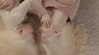 "Снежная красота". Как живут сестры-альбиносы в Актау