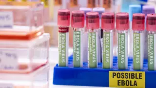 Второй пациент с Эболой умер в Конго