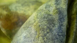 Ученые выделили четыре явных симптома рака легких