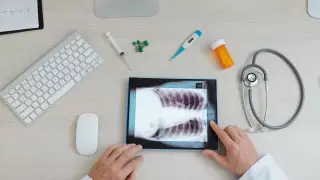 Искусственный интеллект обучили определять расу человека по рентгеновским снимкам