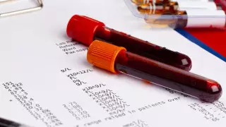 Суточный прирост заражений COVID-19 снова вырос в Казахстане