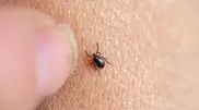 "Максимальный срок - три дня!" Инфекционист рассказал, что делать при укусе клеща