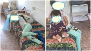 "Закидали камнями". 8-летней девочке из Алаколя поставили диагноз