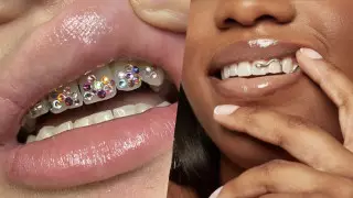 Камни, золото и стразы. Тренд на украшения для зубов возвращается