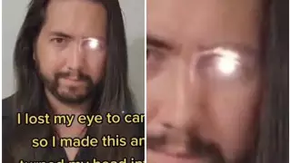 Тиктокер из США потерял глаз и соорудил протез в виде фонарика