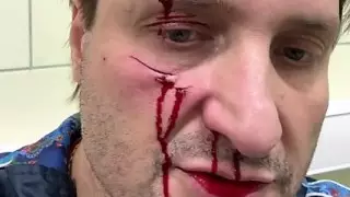 Тигр травмировал дрессировщика Эдгарда Запашного