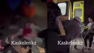 Девушку дважды сбили на дороге в Каскелене