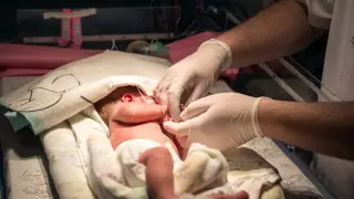 Новорожденному из ЗКО ампутировали руку в Астане