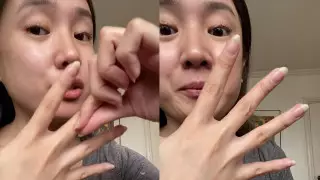 Ущипните палец: работает ли популярный в соцсетях тест на обезвоживание