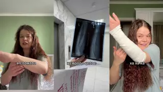 Алматинка серьезно повредила руку, играя на смартфоне