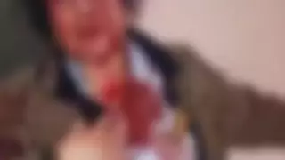 Медработница избила коллег чайником в Узбекистане