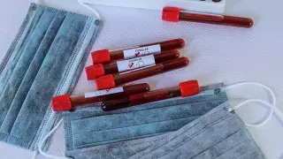 В Казахстане выявили 33 заболевших коронавирусом