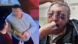 "Ногами по голове и ребрам". Пожилого охранника жестоко избили в Шымкенте