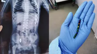 Почему детям не стоит играть с магнитными игрушками, рассказали костанайские врачи