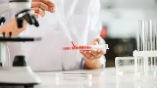 Более 70 случаев кори зарегистрировано в Алматы