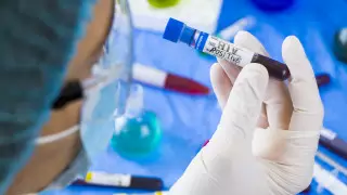 Выявление ВИЧ в алматинской больнице прокомментировала глава Минздрава