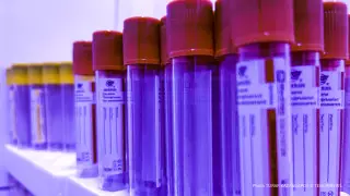 Заболеваемость ВИЧ в Казахстане увеличилась в два раза