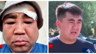 Бизнесмен обвинил депутата в жестоком избиении в Туркестанской области